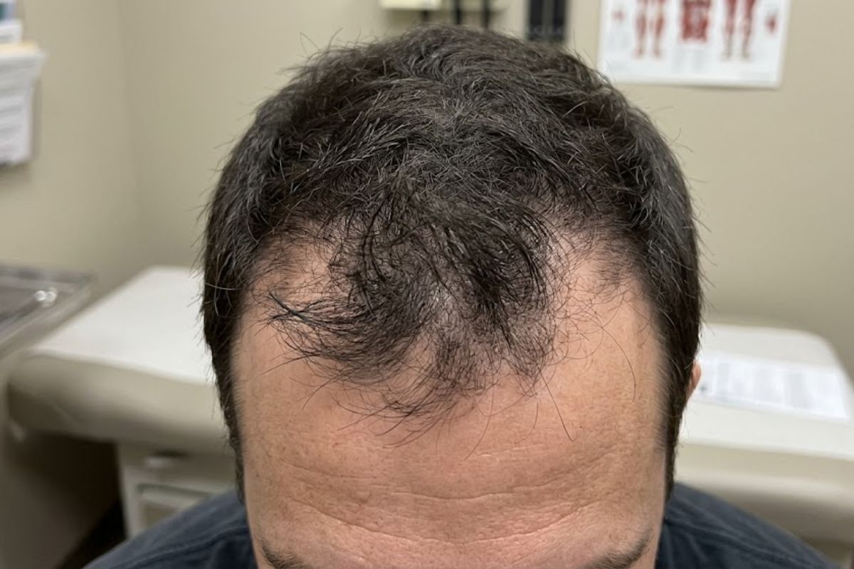 Before treatment